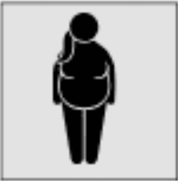 Obese Women