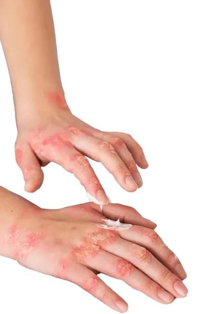 How to use Hafoguard cream